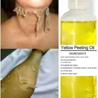 Yellow Peeling Oil EXTRA STRENGTH Skin Lightening Brightening Rejuvenating 30ml
