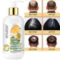 300ml Rice Shampoo Anti Hair Loss Hair Shampoo Professional Repair Damage Hair, Hair Growth DENSE,ANTI ITCHING