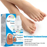 Fungus Nails Treatment for Fingernails Toenails Repair Onychomycosis Paronychia Anti Infection Toe Nail Fungal Removal Liqu S7Z3