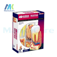 Tooth structure Post Master 4D assembly human anatomy model medical model tooth model biological experiment Free shipping