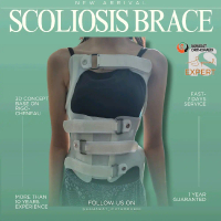 Scoliosis Brace Cheneau 3D Concept by Sahabat Orthopaedi Desain Inovatif Berdasarkan Prinsip 3D Solu