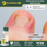 Propolis SM Perawatan Untuk Cantengan Jempol Kaki Tangan, Bengkak, Bernanah Berdarah, Kuku Rusak, Ku