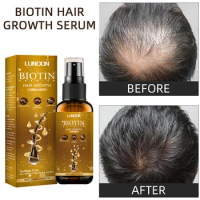 Powerful Hair Growth Fast Woman Biotin For Hair Spray Beard Hair Loss Care Thickening Hair Serum Hair Growth Solution Products