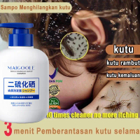 Selenium Disulfide Shampoo Oil Control Anti-Dandruff Anti-Itch Clear Malassezia Pengendalian Minyak 