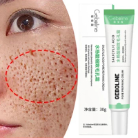 Salicylic Acid Pore Shrinking Cream Quick Remove Blackehead Tighten Face Smooth Skin Elimination Large Pores Korean Care Product