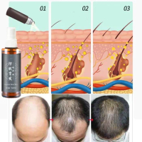 Magic Hair Regrowth Spray Essence Serum Health Hair Grow Liquid Hair Loss Ginger Hair Tonic Oil for Men Women