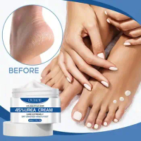 45% Urea Cream Anti-dry Cracking Moisturizing Hydration Urea 30g Cream Foot Hand And Cream O2u2