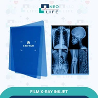 FILM X-RAY INKJET RONTGEN