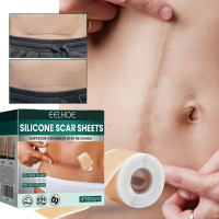 EELHOE Silicone Scar Sheet Plester Penghilang Bekas Luka Stretch Mark Penghapusan Scar Silikon Bekas