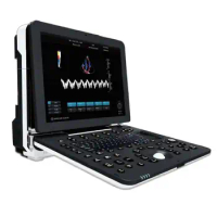 Doppler Laptop Ultrasound Machine with 15-Inch full-view medical HD display on the main screen