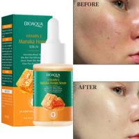 Manuka Honey Gold Face Serum Repairing Essence Moisturizing Oil Control Shrink Pores Lifing Anti-wrinkle Face Serum