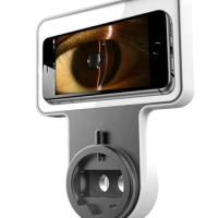 Hot Sale China Digital Slit Lamp Mobile Phone Adapter with High Performance Imaging Module for Ophthalmic Diagnosis