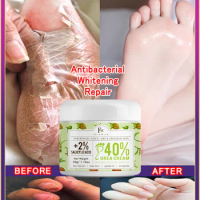 FlowWeek Urea Cream 40% plus salicylic acid 2%, foot cream, suitable for repairing dry and cracked heels, feet, knees, hands and