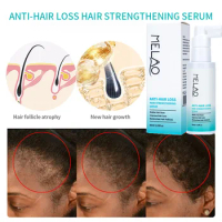 60ml Hair thickening spray promotes hair growth dense hair serum spray scalp treatment spray