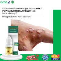 Propolis sm Penghilang Jamur Kulit Gatal Menahun