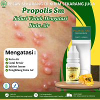 Propolis Sm - Untuk Atasi Kutu Air, Penghilang Kuman Air, Gatal Berair, Kutu Air di Kaki dan Tangan,