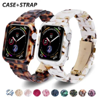 Resin Case+Strap for Apple Watch Series 9 41mm 45mm Band 38 40mm Cover Woman Bracelet for iWatch 8 7 6 SE 5 4 42 mm 44mm Correa