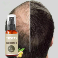 Hair Growth Spray Extract Prevent Hair Loss Growing Hair for Men Professional Brazilian Keratin Spray Growth for Men