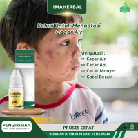 Propolis SM - Solusi Untuk cacar Air & Bekas Cacar,Cacar api,  Pengering Luka Cacar, Cacar Air Untuk