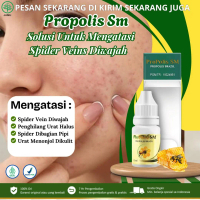 Propolis Sm - Solusi Untuk Menghilangkan Spider Veins, Penghilang Urat Halus di Wajah, Anti Spider V