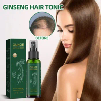 OUHOE Powerful Hair Growth Oil Prevent Hair Loss Products Essence Neo Genuine Ginseng Extract Hair Growth Spray Hair Anti-Fall