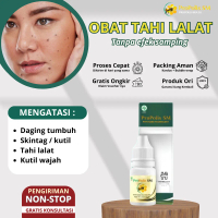 Penghilang Tahi Lalat di Wajah Penghilang Tahi Lalat Yang Lembut Dengan Formula Herbal Untuk Memperb