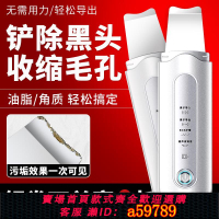 【台灣公司 可打統編】吸黑頭儀器美容院專用黑頭鏟電動超聲波臉部清潔去黑頭粉刺鏟皮機