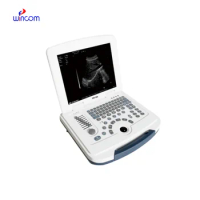Medical Laptop Notebook Portable Ultrasound Machine Ultrasound Scanner System Device Instruments Price