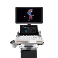 Products subject to negotiationSonoscape P60 Exp Mobile digital ultrasound machine 2D 3D 4D Color Doppler ultrasound system