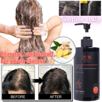 Anti-hair Loss Shampoo Repairs Hair Roots and Improves Hair Loss Ginger Hair Growth Oil Control Nourishing Anti-dandruff Shampoo