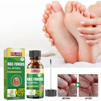 Onychomycosis Repair Solution Toenail Tea Tree Oil Finger Thick Soft Nail Treat Fungal Anti Infection Hand Foot Nails Care Serum