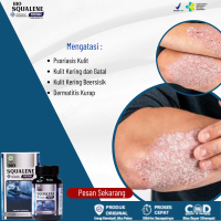 Suplemen Untuk Mengatasi Psoriasis Kulit, Eksim Kering, Kulit Kering Berkerak, Gatal Kulit - Bio Squ