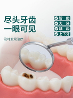 牙齒內窺鏡牙鏡子口腔鏡看牙醫科家用檢查工具剔牙結石去除器套裝