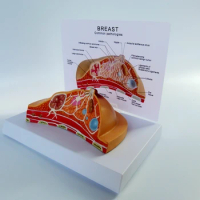 breast common pathologies anatomy model Breast disease Tumor with instructions Medical education
