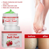 Foot care cream anti-freeze cracking moisturizing Anti dry peeling rough cracked Exfoliator removal hands and feet repair