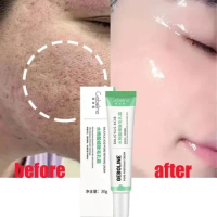 Salicylic Acid Pore Shrinking Cream Quick Elimination Large Pores Remove Blackehead Tighten Face Smooth Skin Care Products 2024