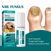 Nail Fungal Treatment Feet Care Essence Nail Foot Clean Odor Fungus Removal Gel Anti Infection Paronychia Onychomycosis