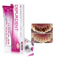 Whitening Toothpaste Removal Tartar Preventing Periodontitis Remover Oral Odor Freshens Breath Toothpaste Cleansing Care