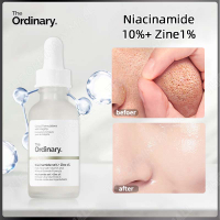 Serum the ordinary Niacinamide 10 + Zinc 1 Serum dưỡng da phục hồi da chính hãng