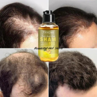 Unisex Anti Hair Loss Ginger Shampoo Hair Growth Products Shampoo Against Hair Loss Mild Treatment Ginger Shampoo For Hair Loss