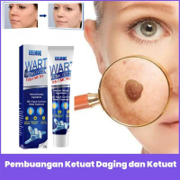 Warts Remover Original Cream Wart Removal Wart Treatment Skin Tags Mole Remover Cream Corn Plaster A