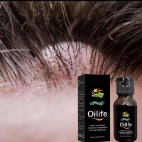 OILIFE - Minyak Oles Benjolan Di Kepala Original BPOM