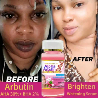 Alpha Arbutin Serum AHA 30%+ BHA 2% Keeps Face Smooth Brightening Moisturizing Improving Dullness Dark Skin Beauty Care Cream