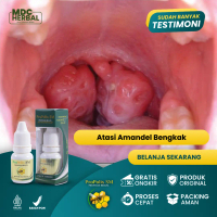 Propolis SM Herbal amandel - amandel normal - radang amandel bengkak - amandel anak - amandel parah
