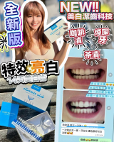 STARSMILECLUB美國藍光美白牙齒機