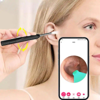 Alat Kesehatan NATFIRE Kamera Endoskopi Pembersih Telinga Otoskop Endoscope HD WiFi - NE17 Viral