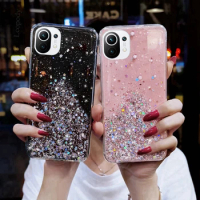 Luxury Bling Glitter Phone Case for Xiaomi mi 11 Lite NE Ultra 5G NFC back case For xiaomi 11 pro Bling Glitter Soft Cover cases