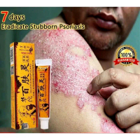 SALEP GATAL CINA AMPUH CAP ORANG TUA MENGOBATI GATAL SELAKANGAN KURAP RUAM EKSIM SCABIES KADAS KUDIS