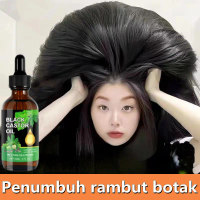 Hair oil rambut rontok Penumbuh rambut Pelebat rambut anak rambut rontok Penumbuh rambut botak Obat 