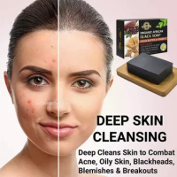 비누 Cocoa Bean Vitamin E Soap African Black Soap Whitening Handmade Soap for Acne Removal Deep Cleansing Jabon Skincare